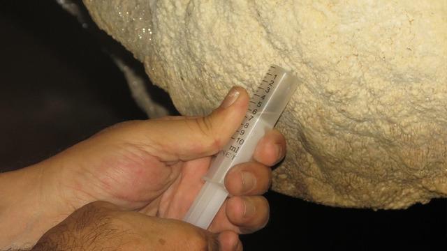 Türkiye'de ilk kez görüldü! Bu bakteri diğerlerinden farklı... İlaç bile yapılması bekleniyor