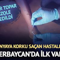 Azerbaycan'da ilk maymun çiçeği vakası! 