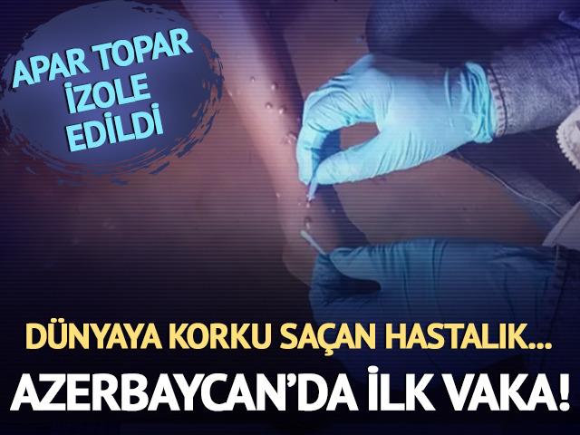 Azerbaycan'da ilk maymun çiçeği vakası! 