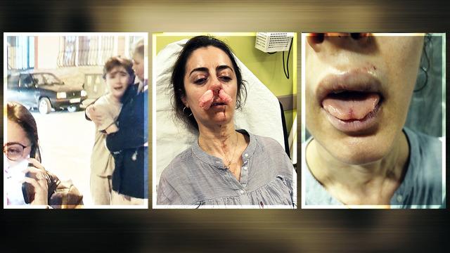 Sokakta gördüğü kadını eşinin sevgilisi sanınca kabus yaşattı: Pardon, eşim beni aldatıyordu