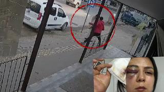 Yer: Kahramanmaraş! Sadece yolda yürüyordu: Dehşete düşüren saldırı anı kamerada! Gözüme perde indi, gözümden kanlar aktı...