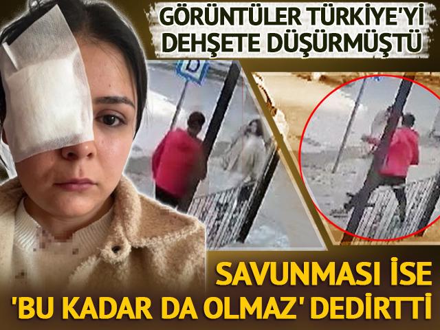 Yolda yürüyen genç kıza yumruk atmıştı! Savunması 'pes' dedirtti