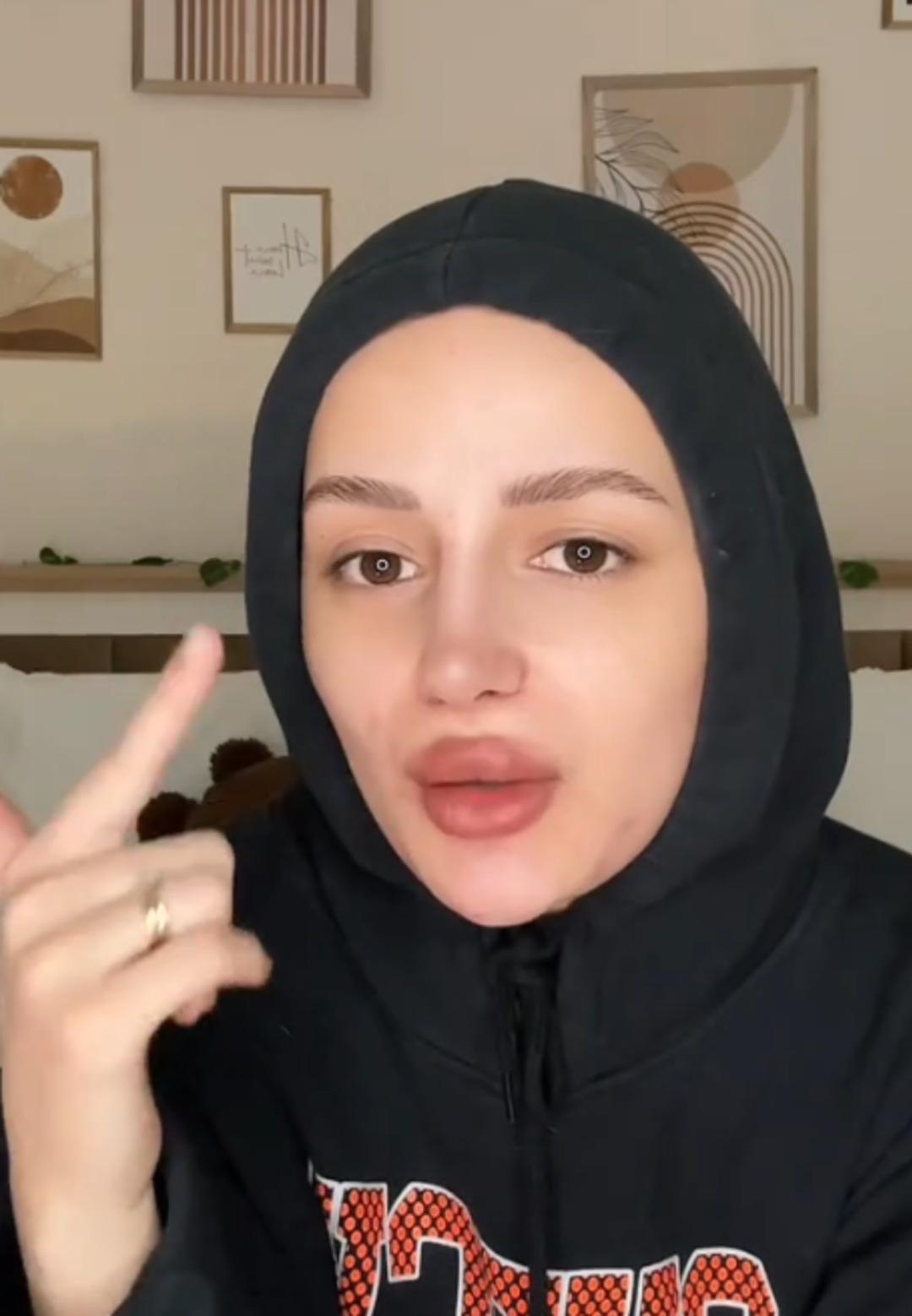 TikTok Fenomeni Gizem Yıldız estetikle bambaşka biri oldu! Görenler şaştı kaldı 2