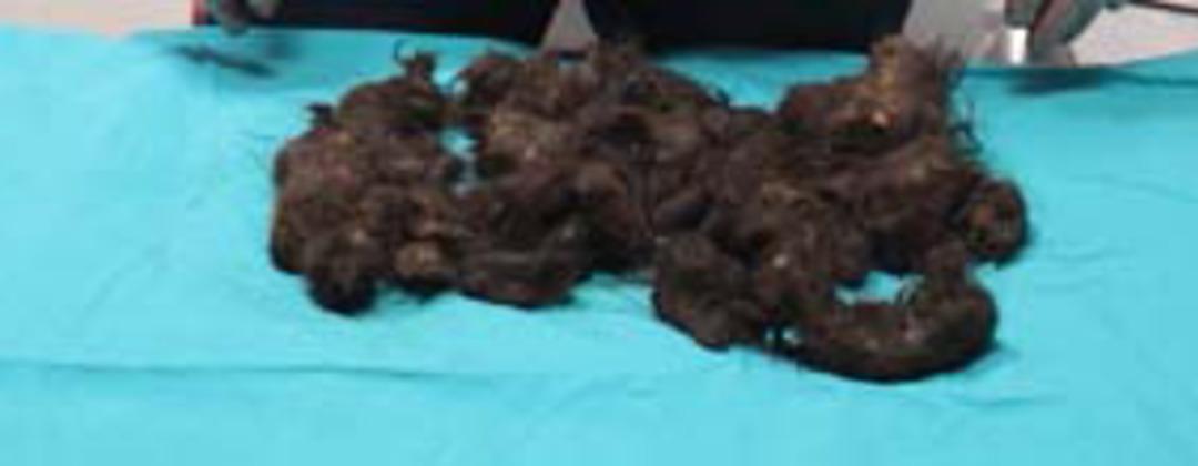 12 yaşındaki kızın midesinden bakın neler &ccedil;ıktı