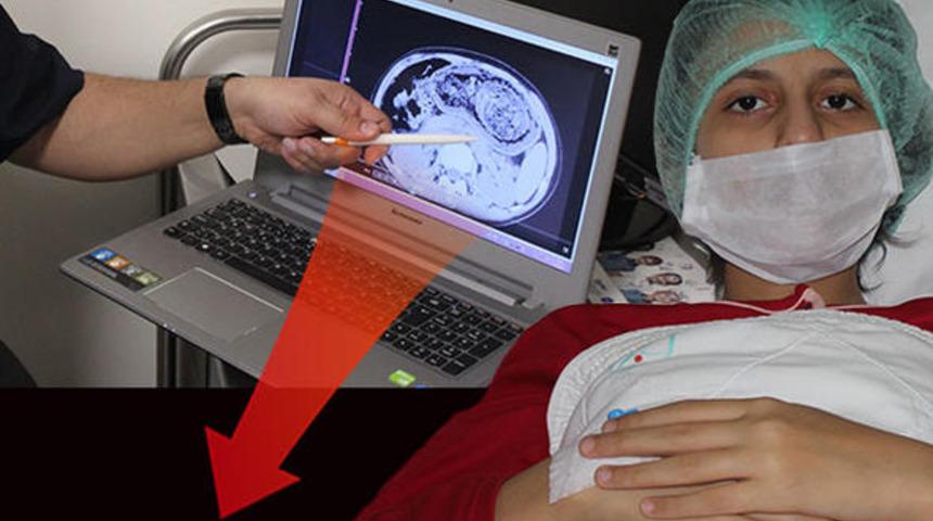 İnanılmaz olay... Sa&ccedil; ve sakız mağduru!