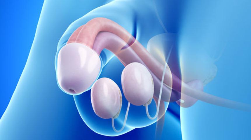 Plastik cerrahlar uyarıyor: Penisinizi beyazlatayım derken yanmayın!