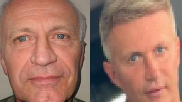 Bir gören bir daha baktı! Bir dizi estetik operasyonun sonrasında 40 yaş gençleşti... Aynı kişi olmadığına yemin edebilirim