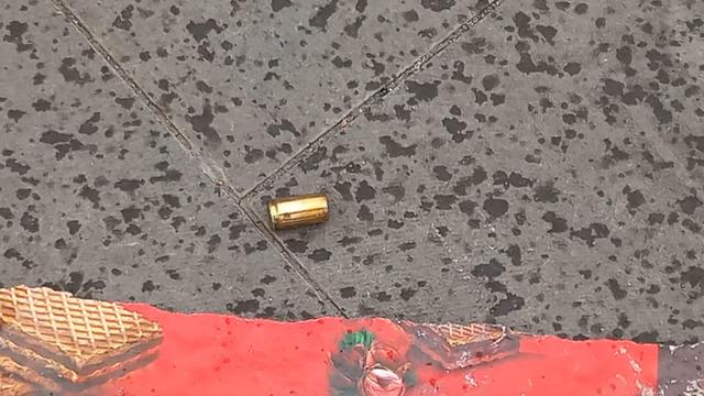 Bu kadarı da pes dedirtti: Sokakta yürürken saldırıya uğradı!