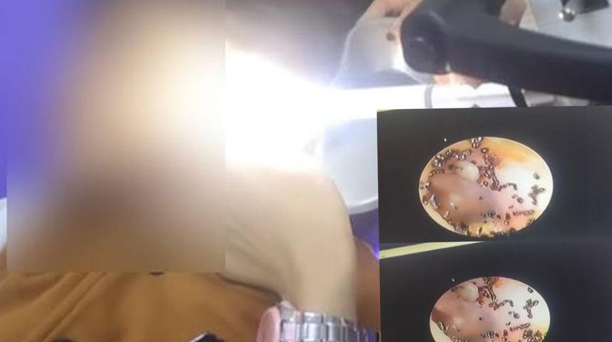 Kulak ağrısından şikayetçi olan küçük kız doktora gidince gerçeği öğrendi! "Çok sayıda kene bulunuyordu"