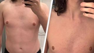 30 gün boyunca hiç yemek yemedi sadece su içti! Vücudunda yarattığı etkiyi gösterince sosyal medyada gündem yarattı