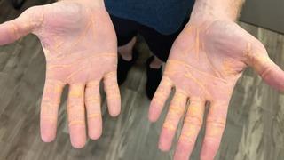 8 ay boyunca sadece peynir, dana eti ve tereyağı yedi! Şoke edici yan etkilerini gösterdi... Sosyal medya onu konuşuyor 