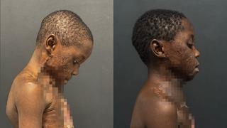 Boynu yanınca çenesi gövdesine yapıştı! Kafasını dahi kaldıramaz hale geldi