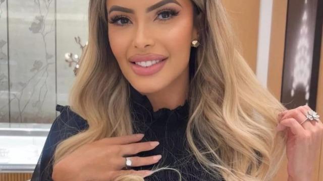 Dünyanın en güzel kadınıyım diyerek kendisini övdü! Estetik operasyonlara 760 bin sterlin  (33 milyon 792 bin TL) harcadı