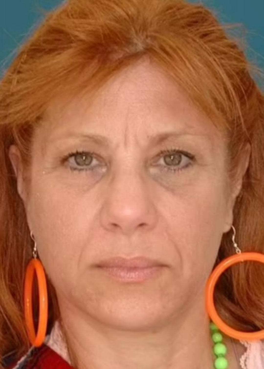 Medeni durumunuz görüşünüzü etkiliyor mu? Evli ve bekar ikizlerin görüntüsündeki farklar şaşkınlık yarattı 1