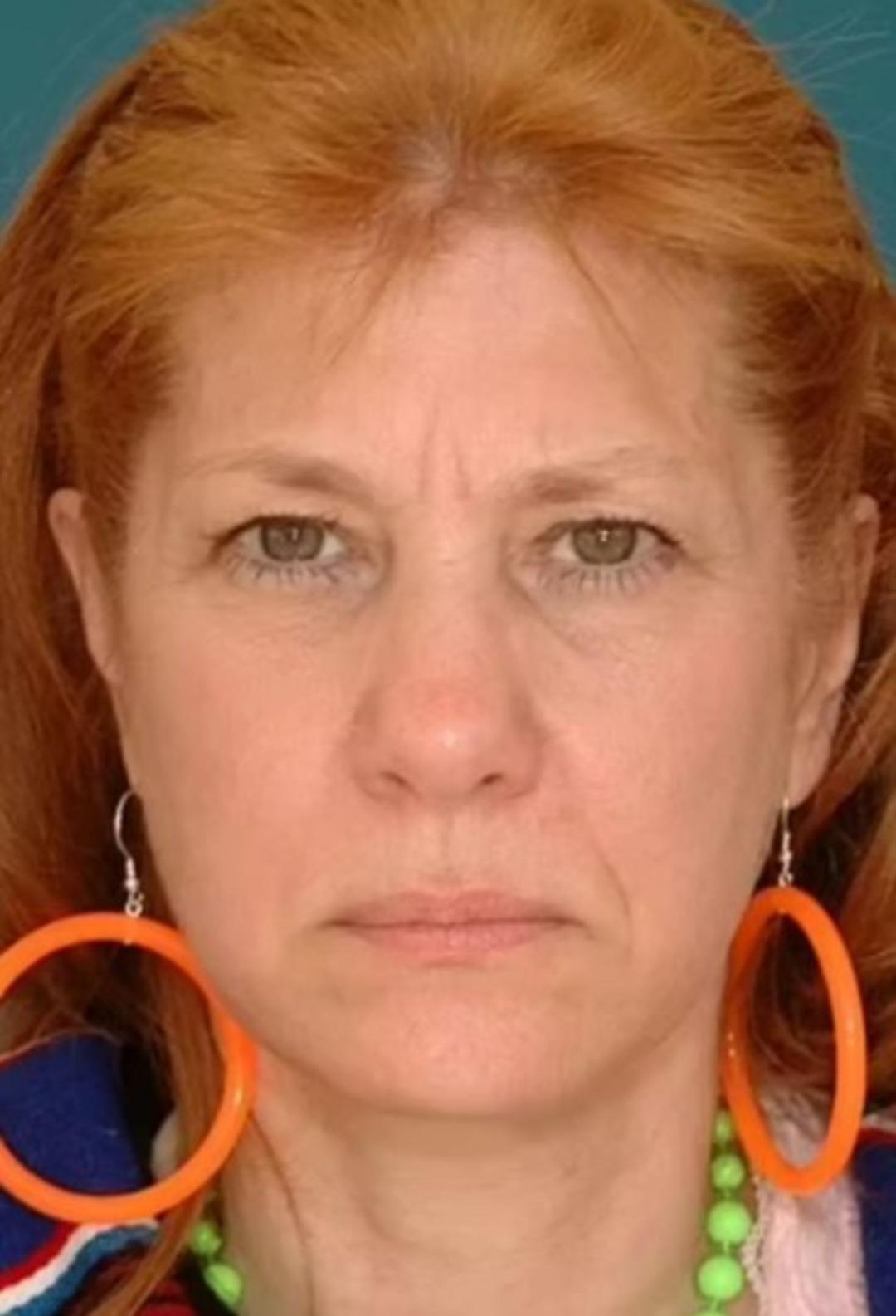 Medeni durumunuz görüşünüzü etkiliyor mu? Evli ve bekar ikizlerin görüntüsündeki farklar şaşkınlık yarattı 2