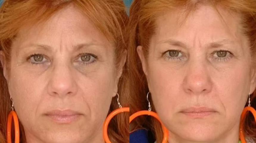 Medeni durumunuz görüşünüzü etkiliyor mu? Evli ve bekar ikizlerin görüntüsündeki farklar şaşkınlık yarattı