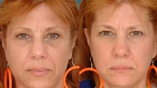 Medeni durumunuz görüşünüzü etkiliyor mu? Evli ve bekar ikizlerin görüntüsündeki farklar şaşkınlık yarattı