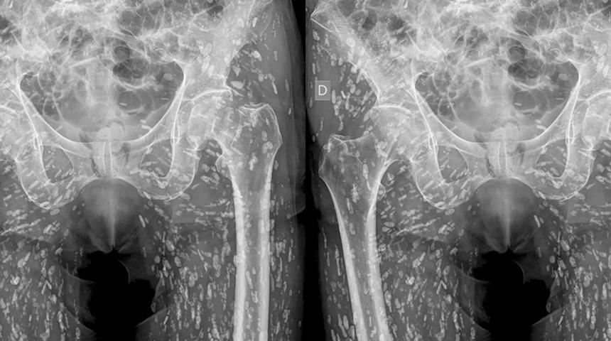 Doktor şimdiye kadar gördüğü en inanılmaz röntgeni paylaştı! Hasta farkına bile varmamış