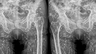 Doktor şimdiye kadar gördüğü en inanılmaz röntgeni paylaştı! Hasta farkına bile varmamış