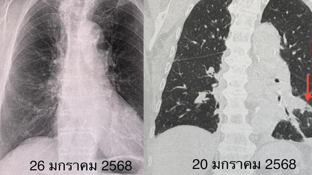 Doktorları şaşırtan röntgen! Aylarca kapalı olan odada kaldı... Sonuçlarına kendisi bile inanamadı