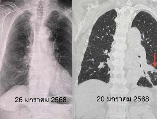 Doktorları bile şaşırtan röntgen! Sonuçlarına inanamadı
