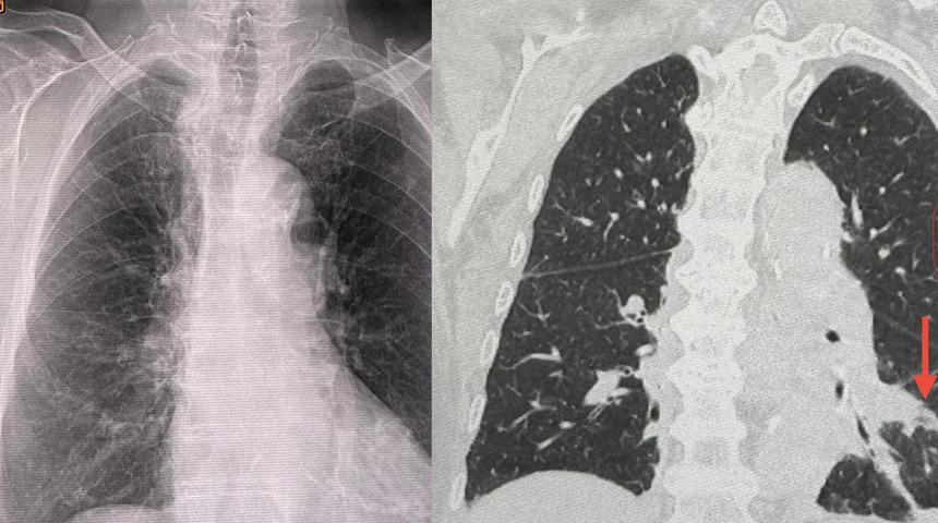 Doktorları şaşırtan röntgen! Aylarca kapalı olan odada kaldı... Sonuçlarına kendisi bile inanamadı