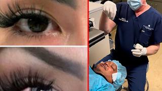 Göz rengini tamamen değiştirmek için göz başına 6 bin dolar (215 bin TL) istedi! Herhangi bir korku filminden daha korkunç