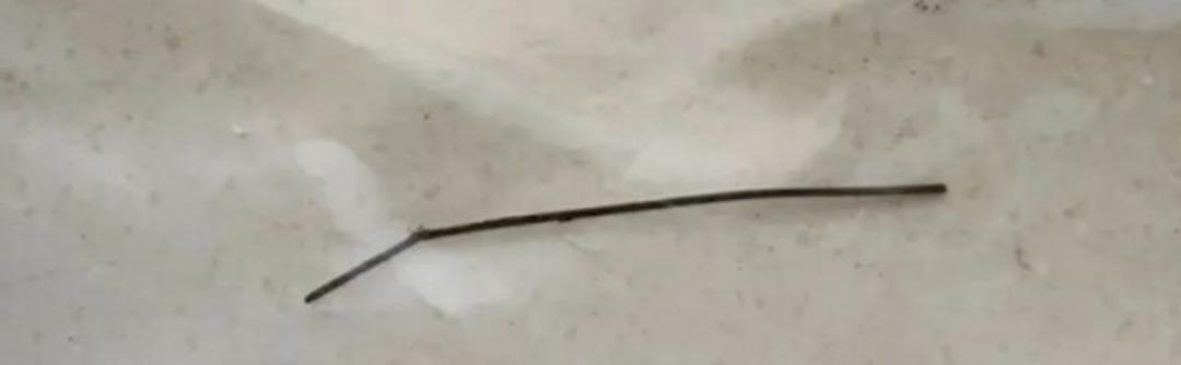 Günlerce tuvaletini yapamadı ve karın ağrısından yürüyemedi! Doktorları şaşırtan röntgen sonucu: Öyle bir şey buldular ki... 2