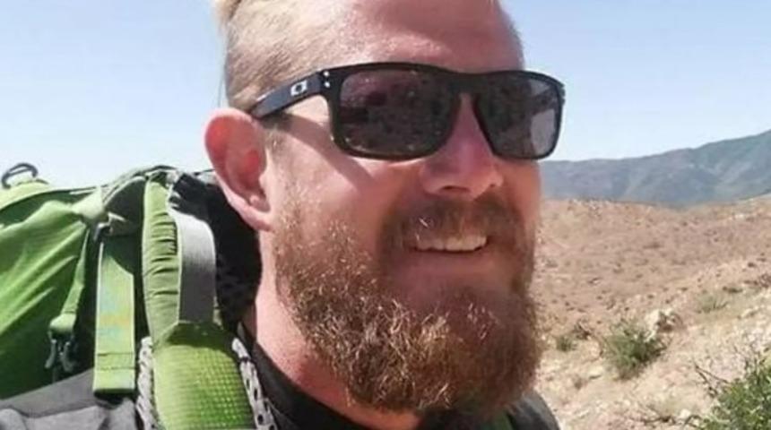 Yemek yaparken parmağını yaktı! Uyandığında iki bacağının kesildiğini öğrendi: "Önemli olduğunu düşünmedim"