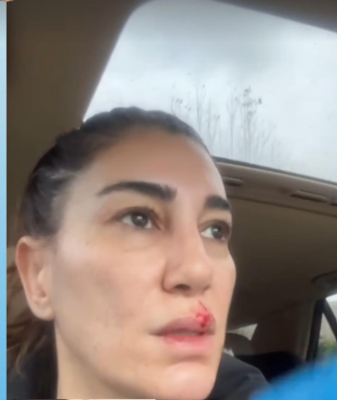 Nadide Sultan temizlik yaparken hastanelik oldu! Kanlar içinde paylaştı 1