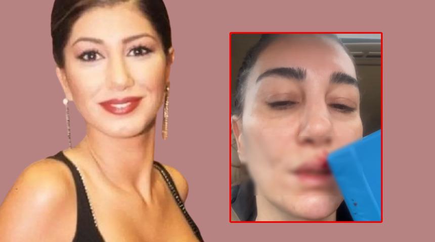 Nadide Sultan temizlik yaparken hastanelik oldu! Kanlar içinde paylaştı