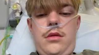 12 yaşından beri e-sigara içiyordu! Günde 50 sigaraya eşdeğer... Sonuçlarını öğrenince şoke oldu: Çok pişmanım