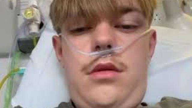 12 yaşından beri e-sigara içiyordu! Günde 50 sigaraya eşdeğer... Sonuçlarını öğrenince şoke oldu: Çok pişmanım