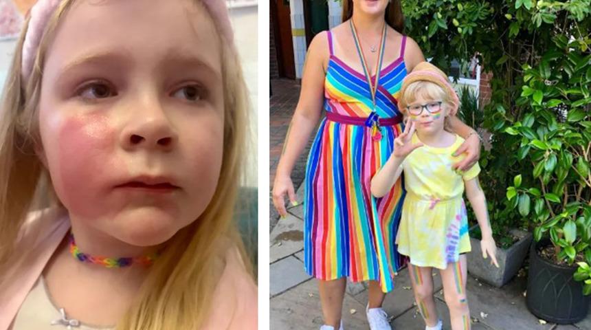 Kızının yanağına bir &ouml;p&uuml;c&uuml;k kondurdu! Dudağındaki ruj kızının yanağını yaktı: " Benim hatamı yapmayın"