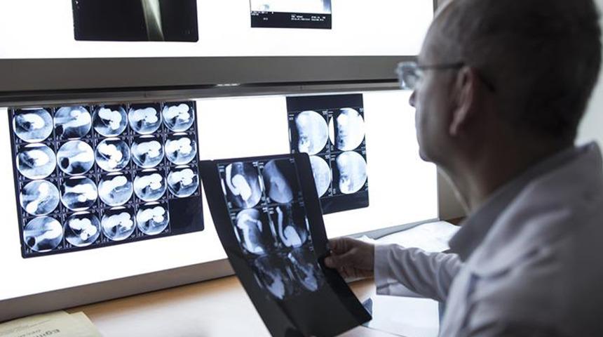 Uzmanlar açıkladı: Bunama sessizce geliyor! Belirtileri 11 yıl önce ortaya çıkıyor... Vücudunuzda bu değişimler varsa dikkat