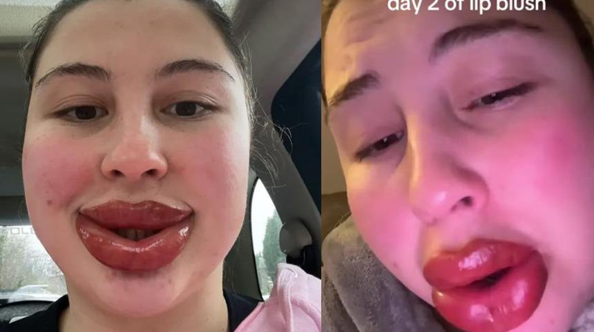 Dudak dövmesini görenler gözlerine inanamadı! Bir anda dudakları 5 katına çıktı: "Hayatımda verdiğim en doğru karardı"