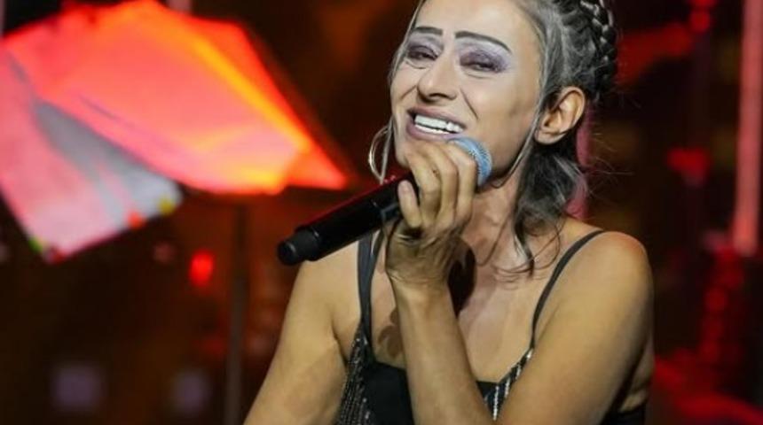 Saç boyası yüzünden yüzü yanmıştı! Yıldız Tilbe son halini gösterdi