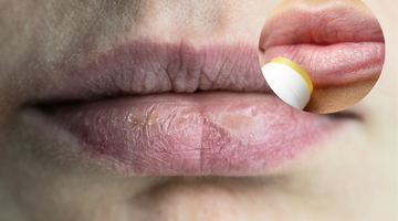 Kış soğuklarında kuruyan dudaklarınıza merhem olacak...