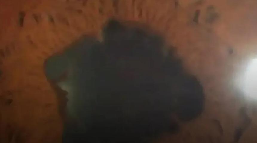 27 yaşındaki  adamın göz bebeklerindeki deformasyon doktorları şaşkına çevirdi! "Nedeni kötü bir alışkanlığı olabilir"