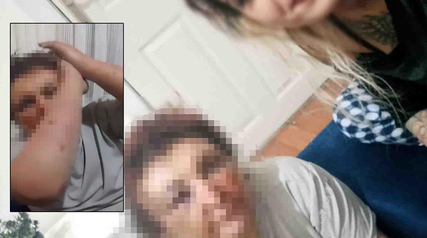 Zorla alıkoydukları kadını darbedip sosyal medyada paylaştılar! Bir de selfie çekilmiş