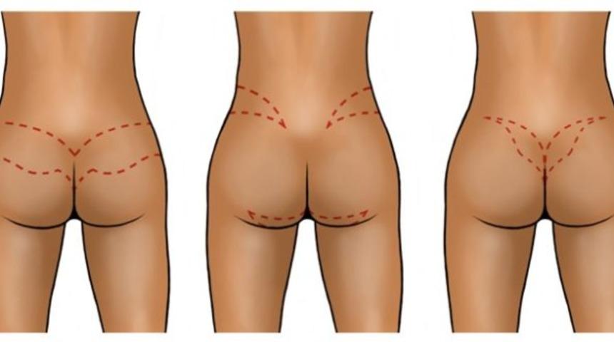 Brezilya poposu hakkında bilmeniz gerekenler