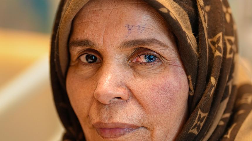 Libya’lı kadına “Asla göremezsin” dediler! Türkiye’de tedavisini buldu: Aydınlığa Van kedisi gözleri ile kavuştu!