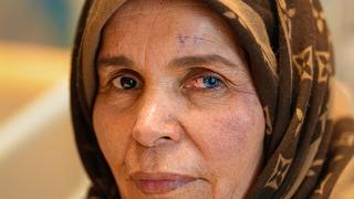 Libya’lı kadına “Asla göremezsin” dediler! Türkiye’de tedavisini buldu: Aydınlığa Van kedisi gözleri ile kavuştu!