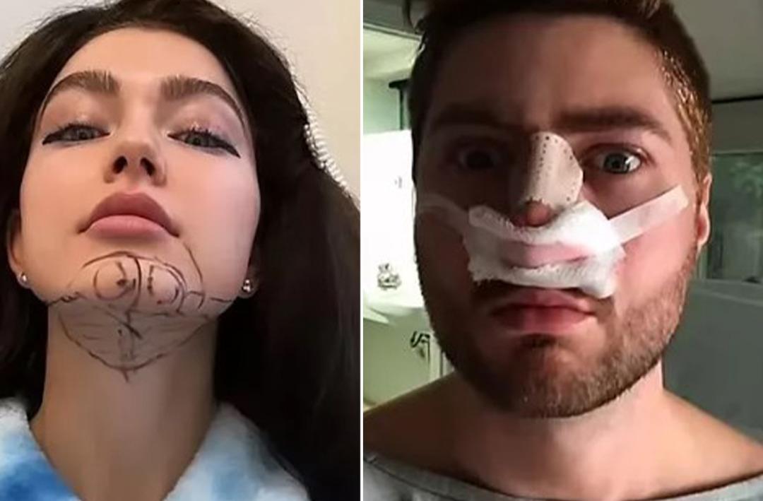 O eski hallerinden eser yok şimdi! Estetik bağımlısı çifti görenler inanamadı: 30 bin sterlin (yaklaşık 1 milyon 372 bin TL) harcadılar: "Daha bitmedi" 2