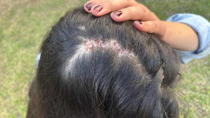 Sağlık çalışanının öbek öbek saçını yolmuşlar! Önce darp edip sonra yere düşürdüler... G2