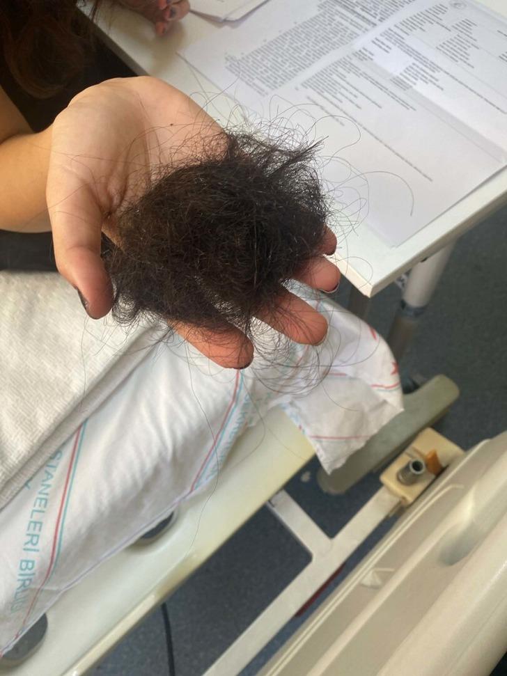 Sağlık çalışanının öbek öbek saçını yolmuşlar! Önce darp edip sonra yere düşürdüler... G3