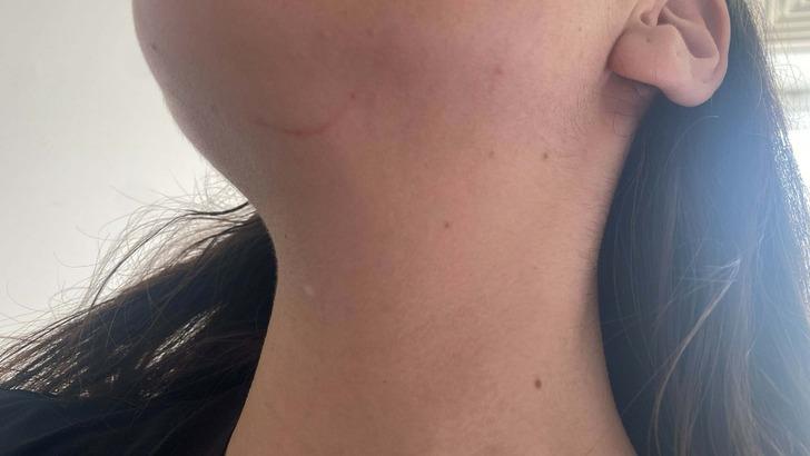 Sağlık çalışanının öbek öbek saçını yolmuşlar! Önce darp edip sonra yere düşürdüler... G4