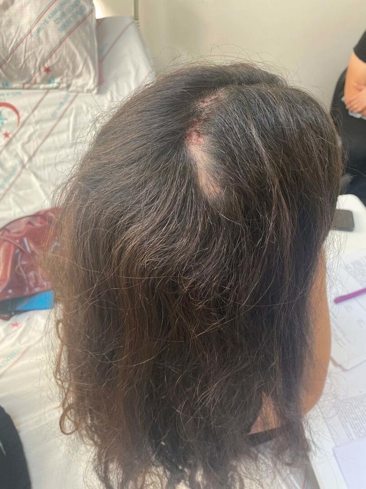 Sağlık çalışanının öbek öbek saçını yolmuşlar! Önce darp edip sonra yere düşürdüler... G5