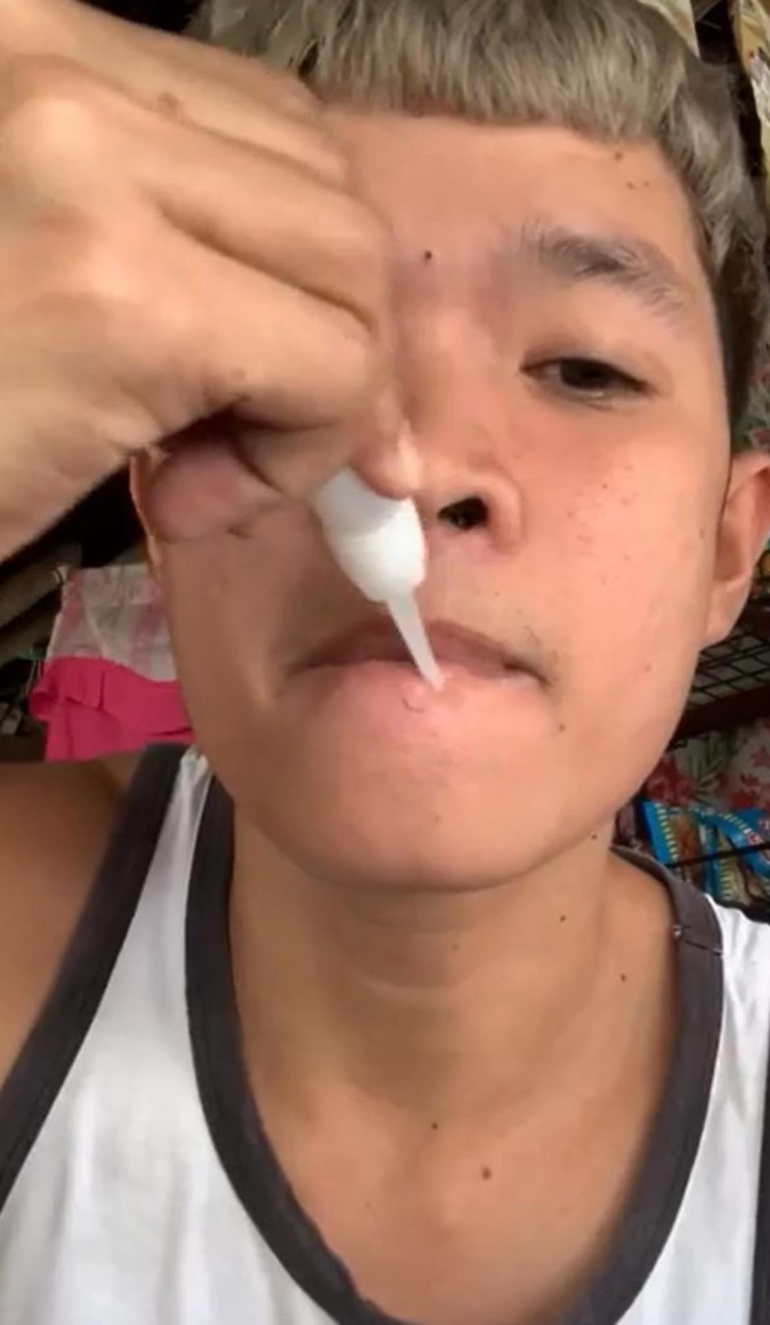 Daha fazla izlenmek için öyle bir şey yaptı ki... Japon yapıştırıcısıyla dudaklarını yapıştırdı, bin pişman oldu: Gözyaşlarını tutamadı 1