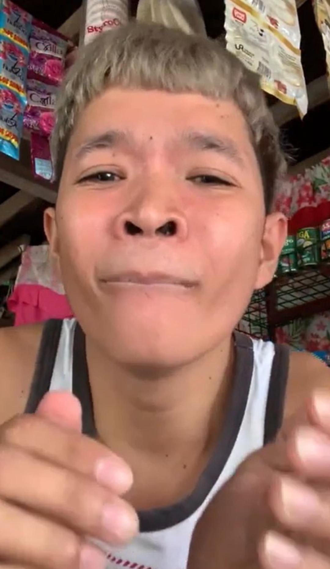 Daha fazla izlenmek için öyle bir şey yaptı ki... Japon yapıştırıcısıyla dudaklarını yapıştırdı, bin pişman oldu: Gözyaşlarını tutamadı 2